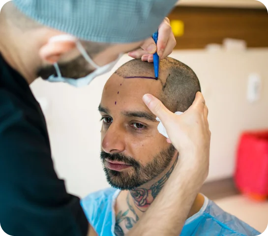 Headshot portrait photography 19 Hair Transplant