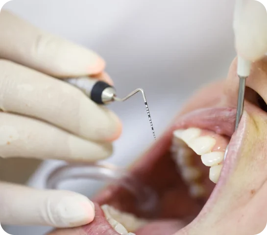 Is dental implant surgery painful?